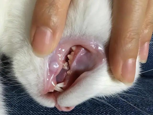 蓝色牙龈